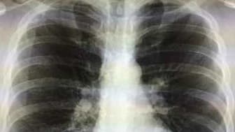 L'application médicale Figure1 devrait arriver en France sous peu.