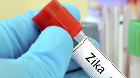 De nombreuses recherches sont déployées pour tenter de corroborer et de préciser le lien entre le virus Zika et divers troubles neurologiques.