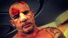 Dominic Purcell s'est blessé sur le tournage de la saison 5 de "Prison Break"