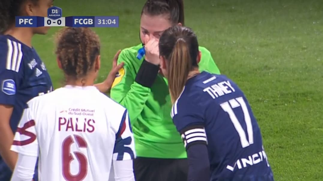 L'arbitre Alexandra Collin touchée au nez lors de Paris FC-Bordeaux. L'arbitre Alexandra Collin touchée au nez lors de Paris FC-Bordeaux.