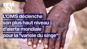 Pourquoi l’OMS a-t-elle déclenché son plus haut niveau d’alerte mondiale pour la "variole du singe"?