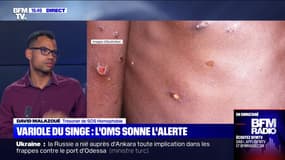 Alerte maximale sur la variole du singe: "Une décision que l'on attend depuis assez longtemps", réagit SOS Homophobie