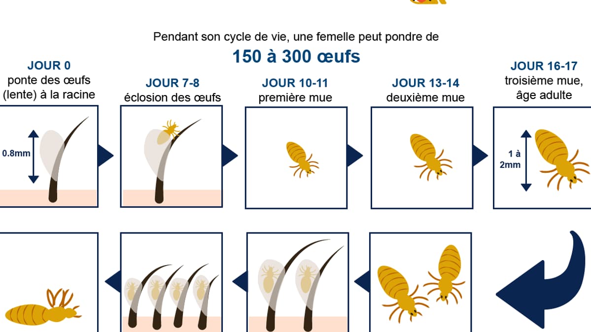 infographie poux infographie poux