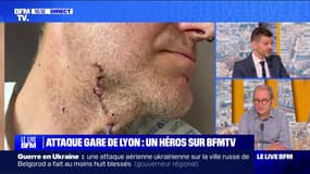 Christophe, victime de l'attaque à la Gare de Lyon: "J'ai frôlé la mort"