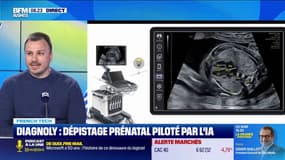 L'entreprise Diagnoly a mis de l'IA dans l'échographie, afin de les sécuriser au maximum