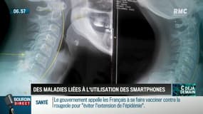 La chronique d'Anthony Morel : Des maladies liées à l'utilisation des smartphones - 15/03