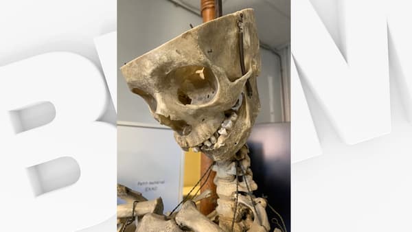 Le crâne du squelette Oscar, dont on ignore la véritable identité et dont on ne peut dater la présence au sein du lycée.