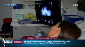 Endométriose traitée par ultrasons: "Je n'ai plus de maux de ventre"