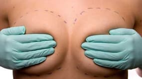 30 000 femmes portent des implants PIP en France.