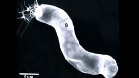 Photographie prise au microscope d'une bactérie « d'origine extraterrestre » découverte sur l'une des météorites.