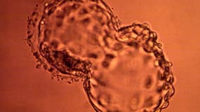 Un embryon humain en éclosion. Photo d'illustration