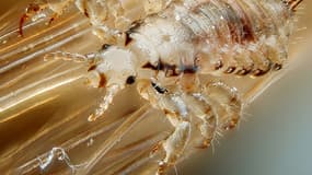 Un pou sur des cheveux.