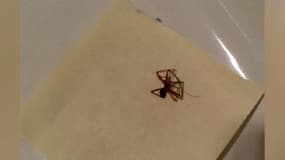 Languedoc-Roussillon: trois personnes opérées après avoir été mordues par "l’araignée violoniste"