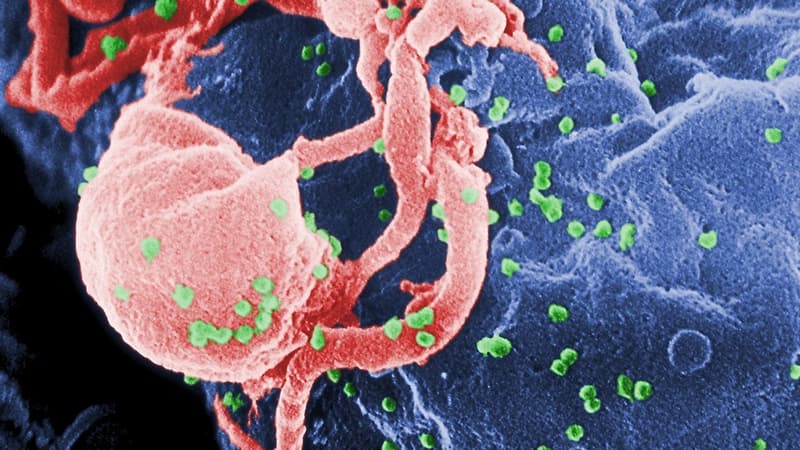 VIH-1 en formation (en vert). (image d'illustration)