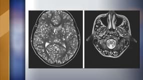 Des images de l'infestation