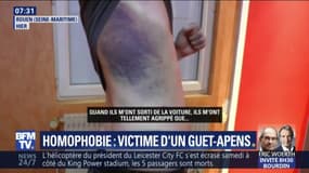 "J'ai vraiment eu peur de mourir." Frappé puis séquestré, cet homosexuel raconte son agression à Rouen