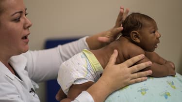 Un enfant atteint de microcéphalie, au Brésil, le 28 janvier 2016. Le lien entre l'explosion en Amérique du Sud du nombre de bébés naissant avec cette malformation congénitale et le virus Zika est, pour l'OMS, "fortement suspecté".