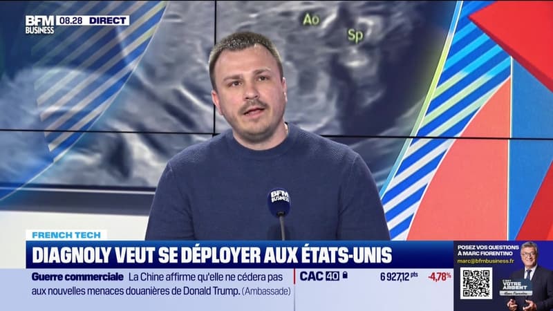 French Tech : Diagnoly, spécialiste du dépistage prénatal - 08/04