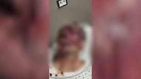 Laurent Dossetti, un Marseillais de 53 ans, agressé le samedi 22 novembre 2025.