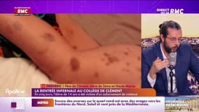 Frédéric père d'un enfant qui subit du harcèlement : "Il est rentré avec des dizaines d'hématomes