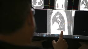 Un médecin observant les poumons d'un fumeur à Ajaccio le 16 décembre 2021 (illustration)
