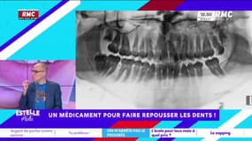 Bientôt un médicament pour faire repousser les dents ?