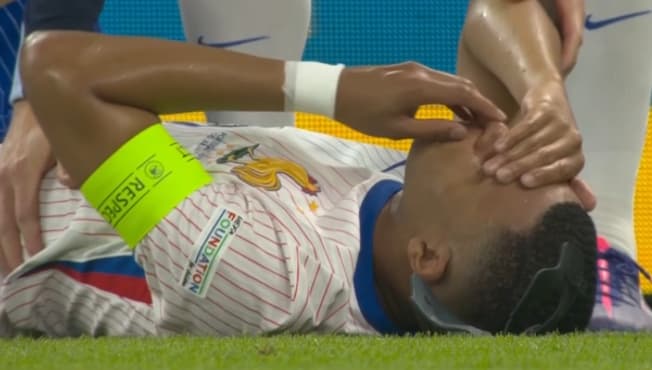 Kylian Mbappé se plaint du nez après avoir pris un ballon dans le visage lors du quart de finale de l'Euro, 5 juillet 2024