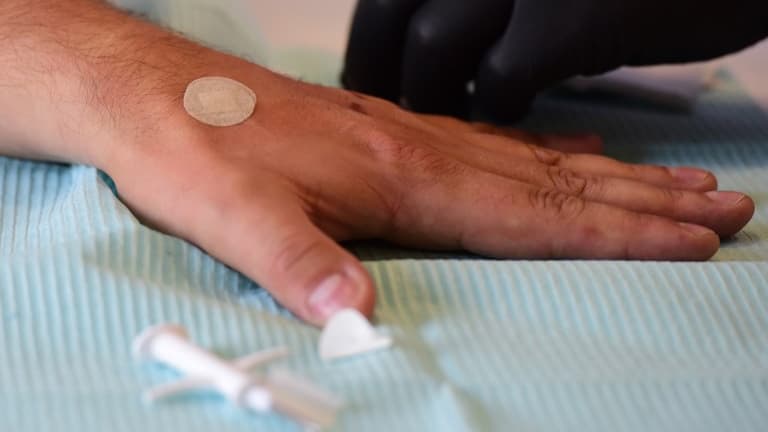 Puce sous-cutanée en France : implant électronique & corporel