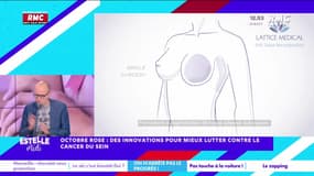 On n'arrête pas le progrès : Octobre rose, des innovations pour mieux lutter contre le cancer du sein - 14/10