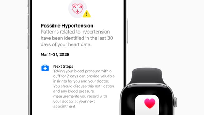 L'Apple Watch Series 11 peut détecter l'hypertension. L'Apple Watch Series 11 peut détecter l'hypertension.