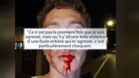 Enquête ouverte en Corse pour une violence agression homophobe: ce que l'on sait
