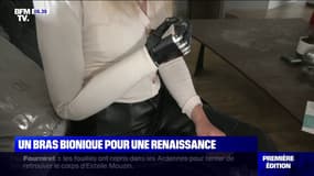 La première Française équipée d'un bras bionique témoigne sur BFMTV