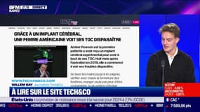 À lire sur le site Tech&Co : Grâce à un implant cérébral, une femme américaine voit ses toc disparaître, par Willem Gay - 05/02