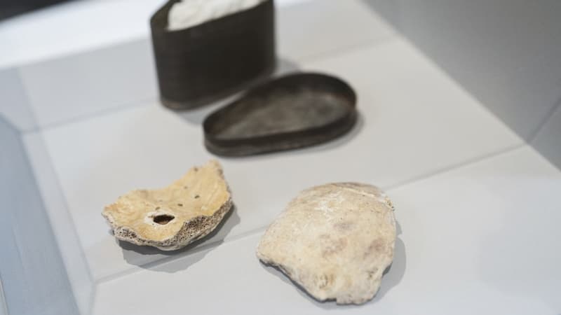 Les fragments de crâne appartenant possiblement à Ludwig van Beethoven exposés à l'Université de médecine de Vienne, le 20 juillet 2023.