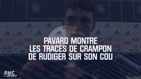 Pavard montre les traces de crampon de Rudiger sur son cou