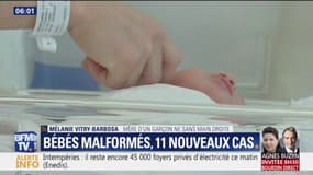 11 nouveaux cas de bébés malformés : pourquoi ce mystère n'a toujours pas d'explication