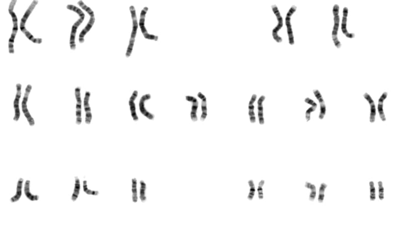 Caryotype du génome humain