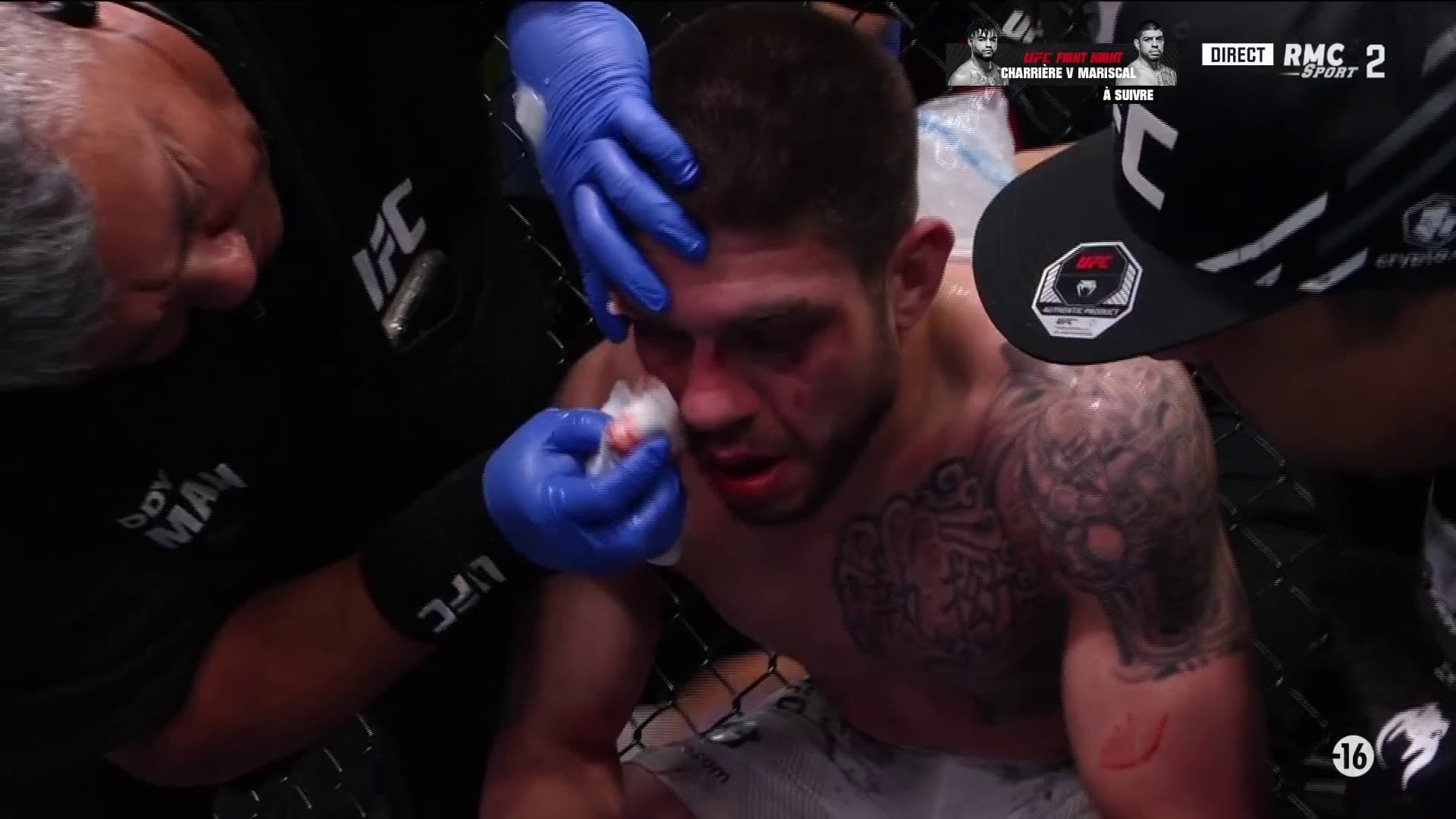 Mariscal très marqué lors de son combat face à Charrière à l'UFC, 6 avril 2024 Mariscal très marqué lors de son combat face à Charrière à l'UFC, 6 avril 2024