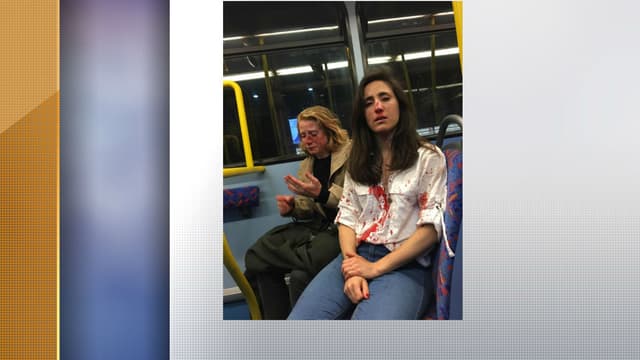 Melania Geymonat a dévoilé sur Facebook la photographie de son visage ensanglanté, et de celui de sa petite amie Chris, après avoir été attaquées dans un bus londonien.