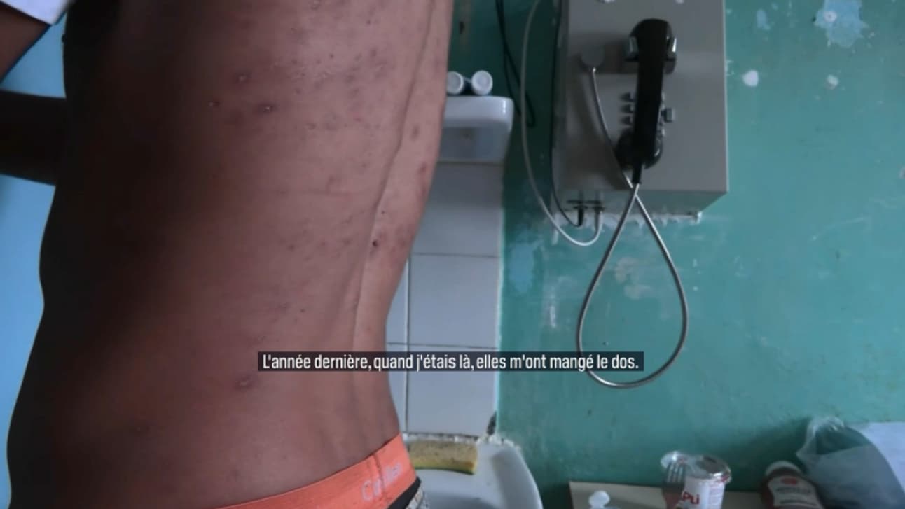Le dos d'un détenu piqué par de nombreuses punaises de lit, prison de Fresnes, 2022 Le dos d'un détenu piqué par de nombreuses punaises de lit, prison de Fresnes, 2022