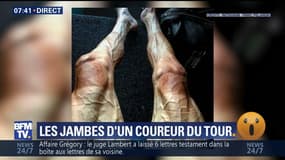 Les jambes d'un coureur du Tour de France - 20/07
