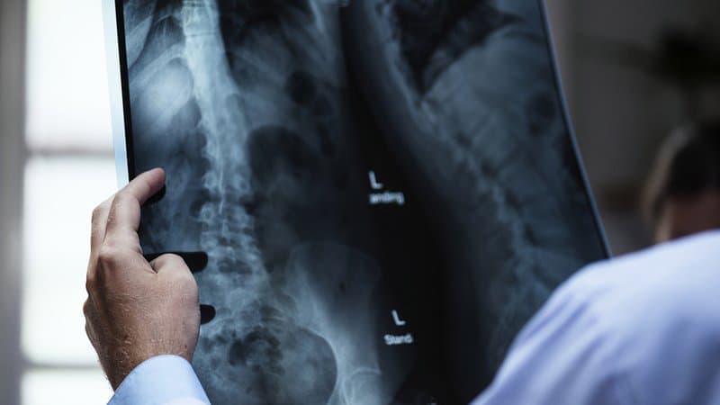 Un médecin tenant une radiographie