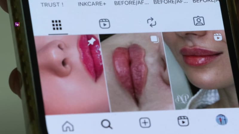 L'injection esthétique pour les fesses vire au drame, un mort: "Il y a des réseaux organisés aux tarifs cassés"