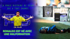 "R9 le film" : Les malformations aux genoux de Ronaldo imagées et expliquées par son physio 