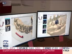 La France qui bouge: 3Dcelo, la technologie au service des dentistes, par Marie Valognes - 31/12