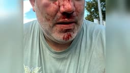 Un policier de Tourcoing a été violemment agressé par cinq jeunes  le 11 septembre dernier