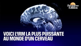 Voici l'IRM la plus précise au monde d'un cerveau (et elle est française)