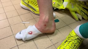 La cheville droit de Lucas Chevalier le 29 novembre 2025