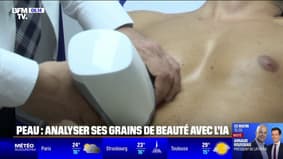 Santé: Analysez vos grains de beauté avec l'IA pour détecter les cancers de la peau