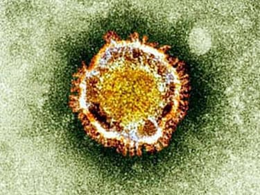 Le coronavirus vu au microscope